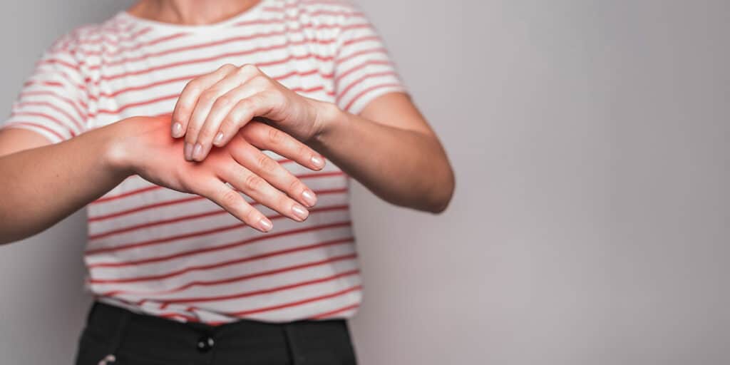 Mulher com dores nas mãos por complicação das artroses - Dr. Marcelo Reumatologista