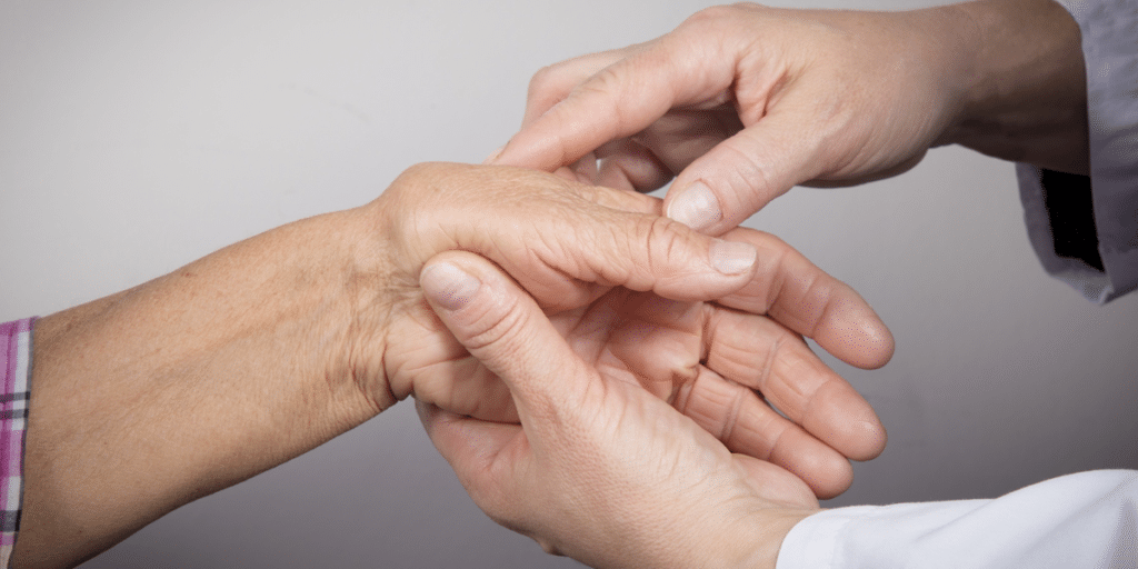 médico examinando a mão de paciente com reumatismo -  site Dr. Marcelo Corrêa Reumatologista