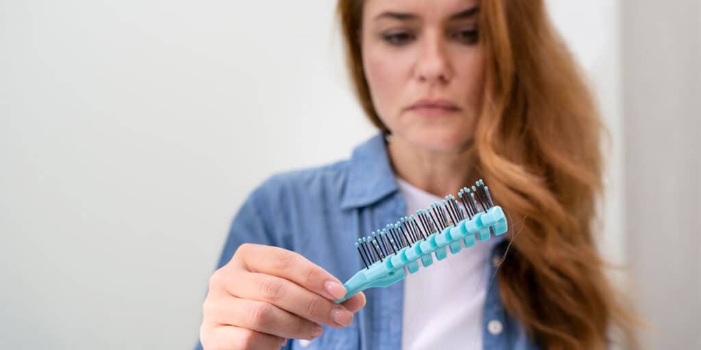 Mulher com queda de cabelo um dos sintomas de lúpus - Dr. Marcelo Corrêa Reumatologista de Belém do Pará